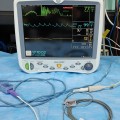 GE Dash 5000 Patient Monitor