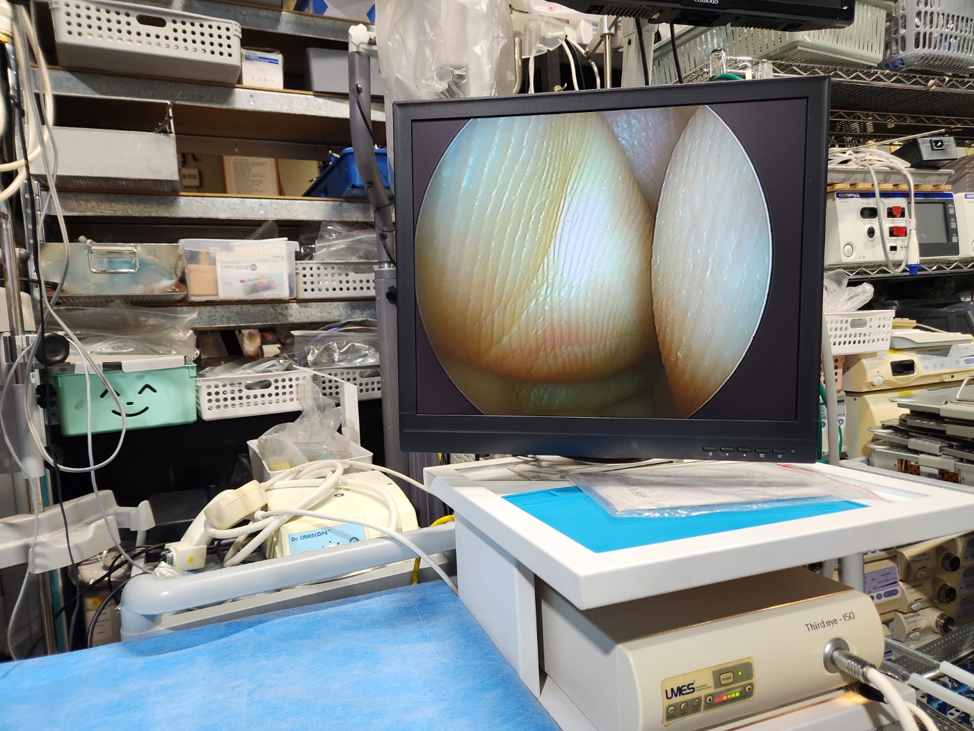 R.Wolf  Panoview Plus 8792.411 20° Spine Endoscope