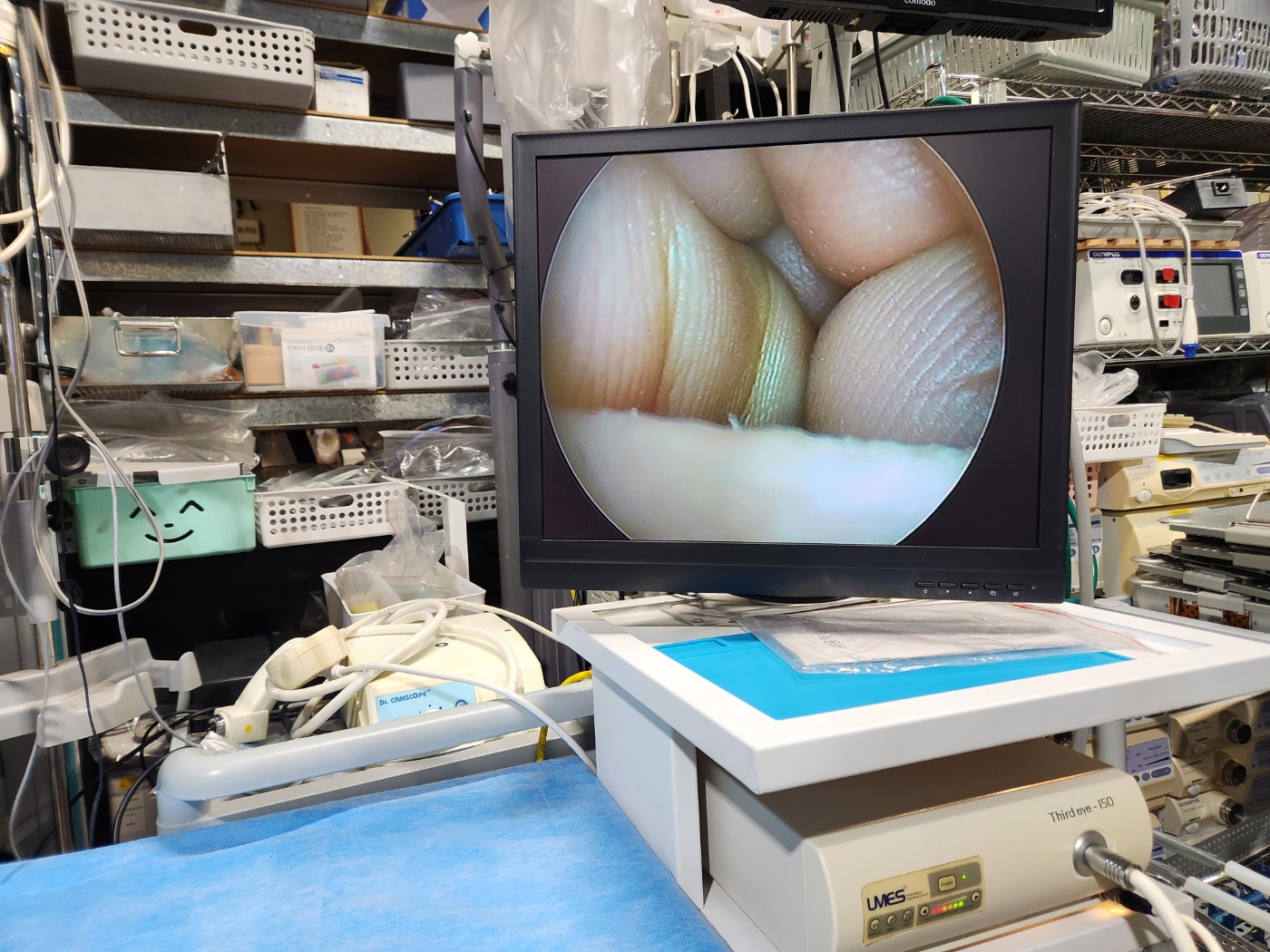 R.Wolf  Panoview Plus 8792.411 20° Spine Endoscope