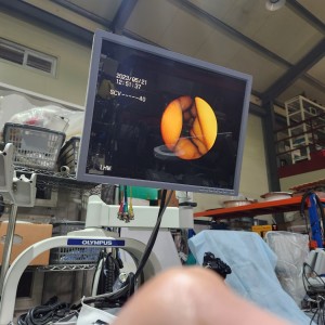 Olympus BF P60 Fiber Bronchoscope