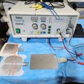 Vesalius MCN Plus electrosurgical unit