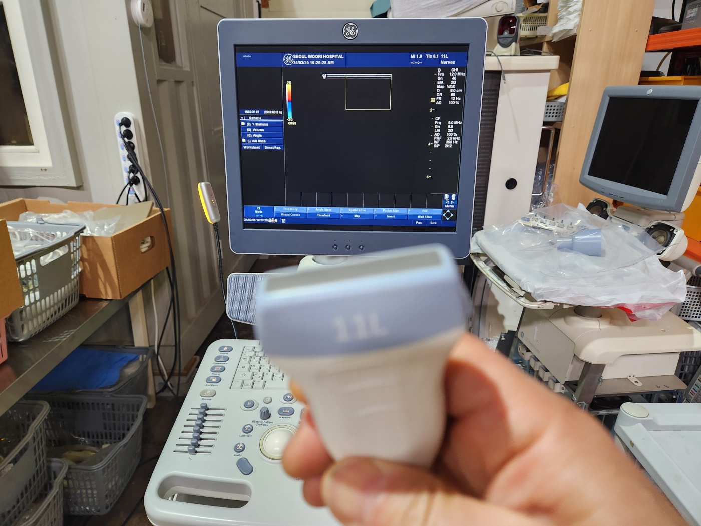 GE LOGIQ P6 Ultrasound System