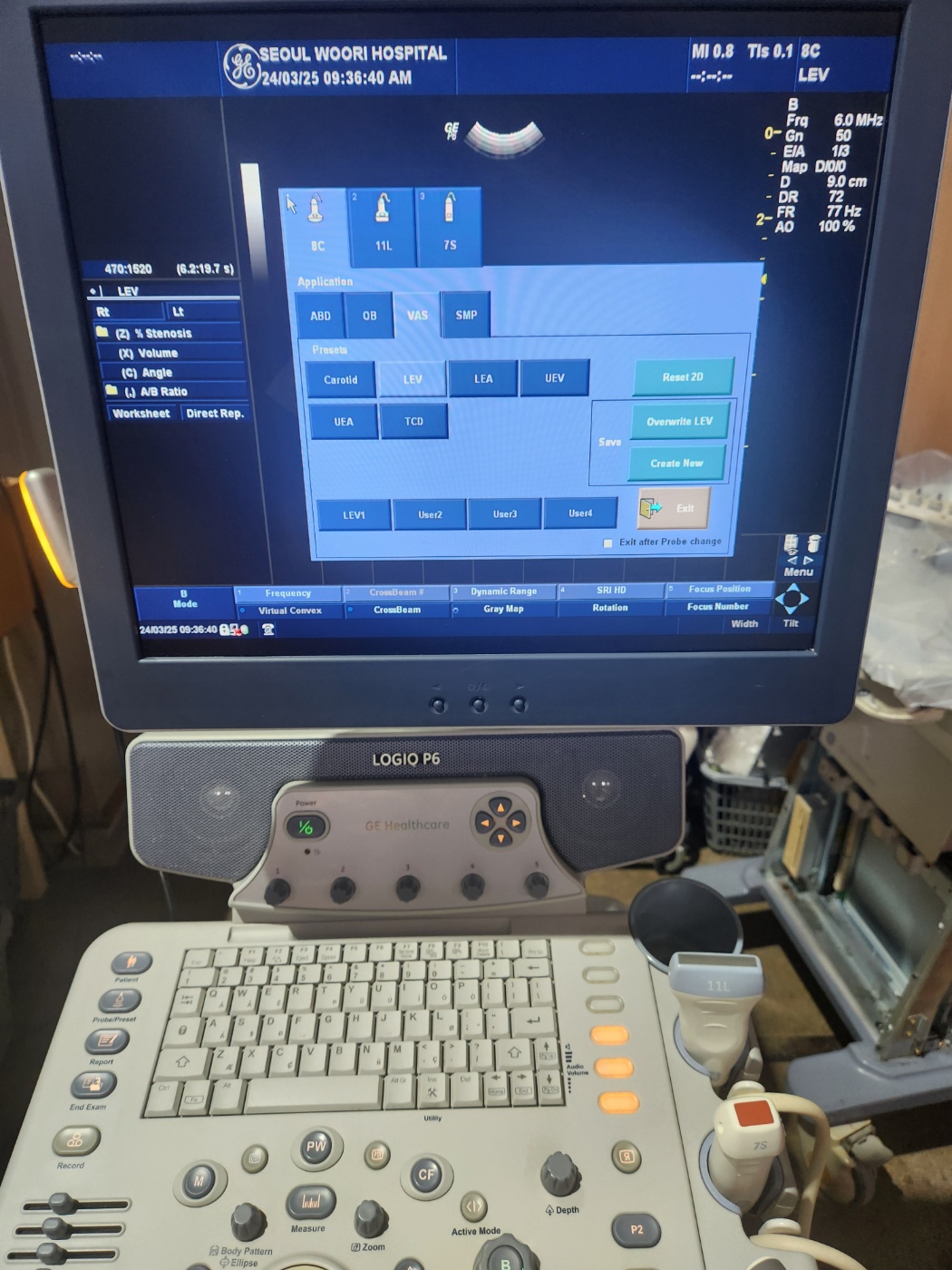 GE LOGIQ P6 Ultrasound System