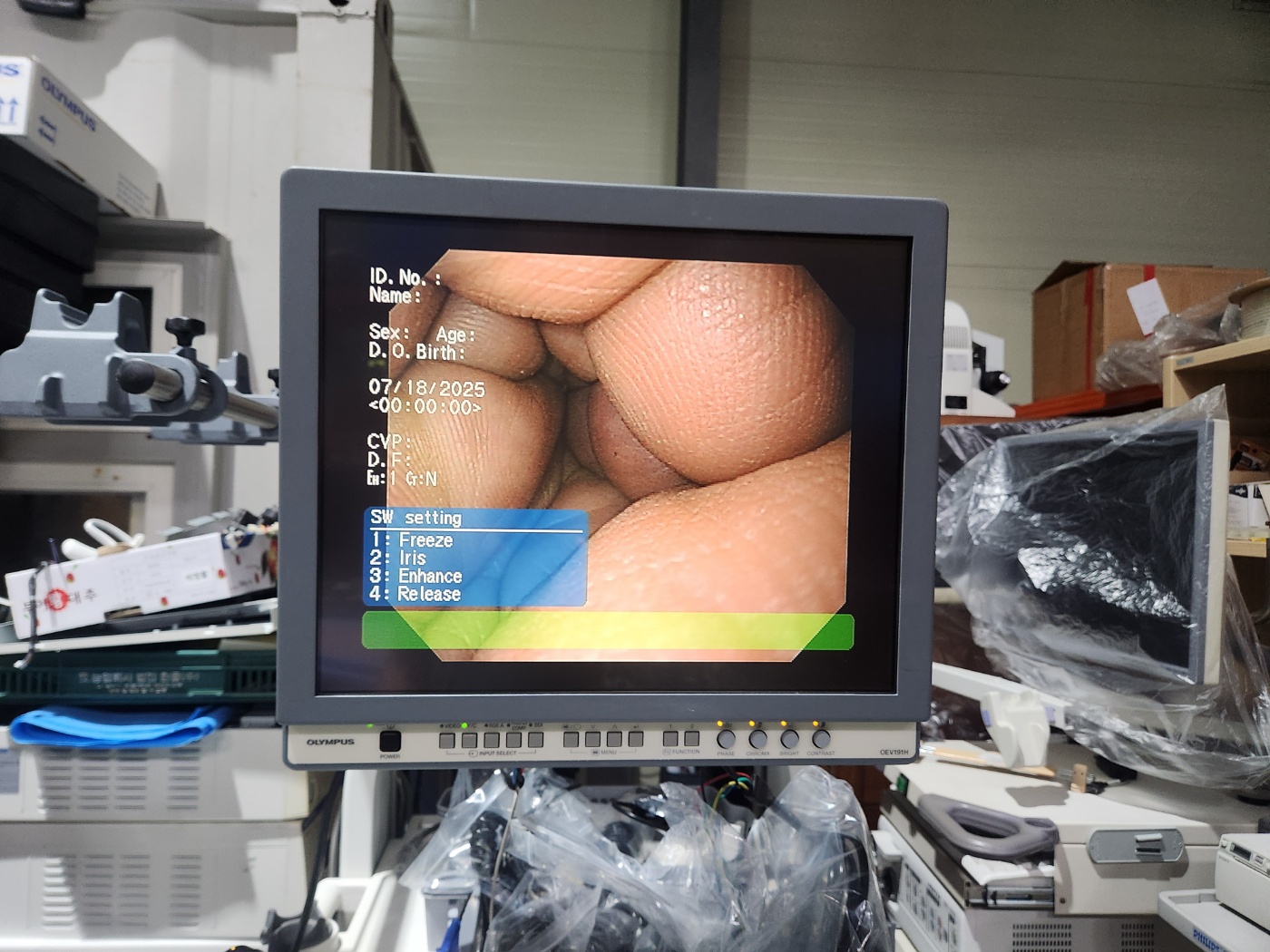 Olympus CV-160 Endoscopy System