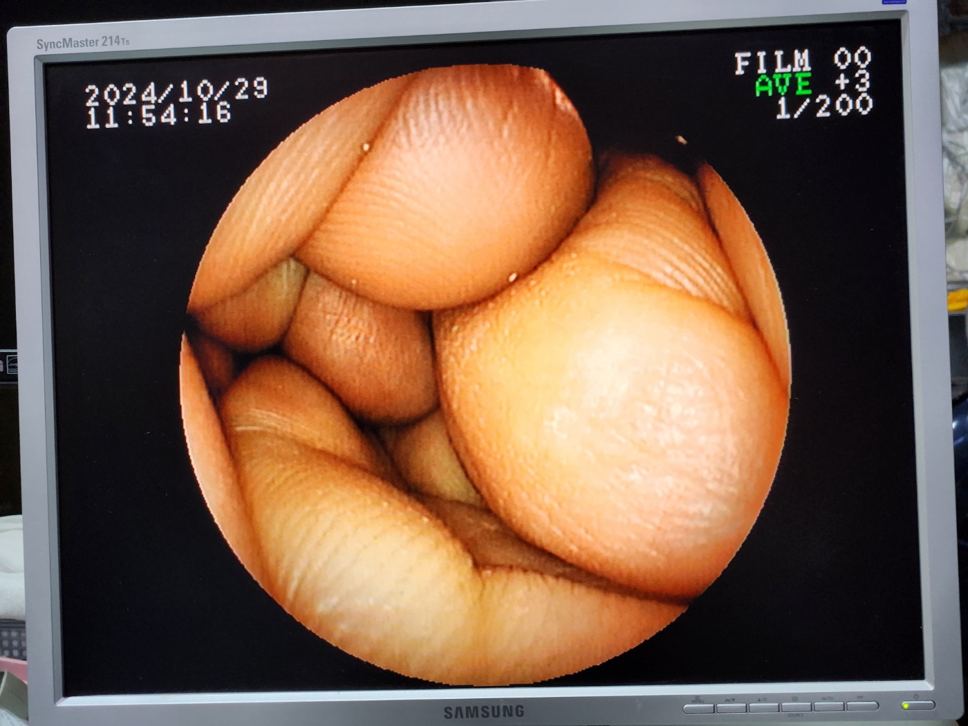 Fujinon EG-270N5  slim Gastroscope