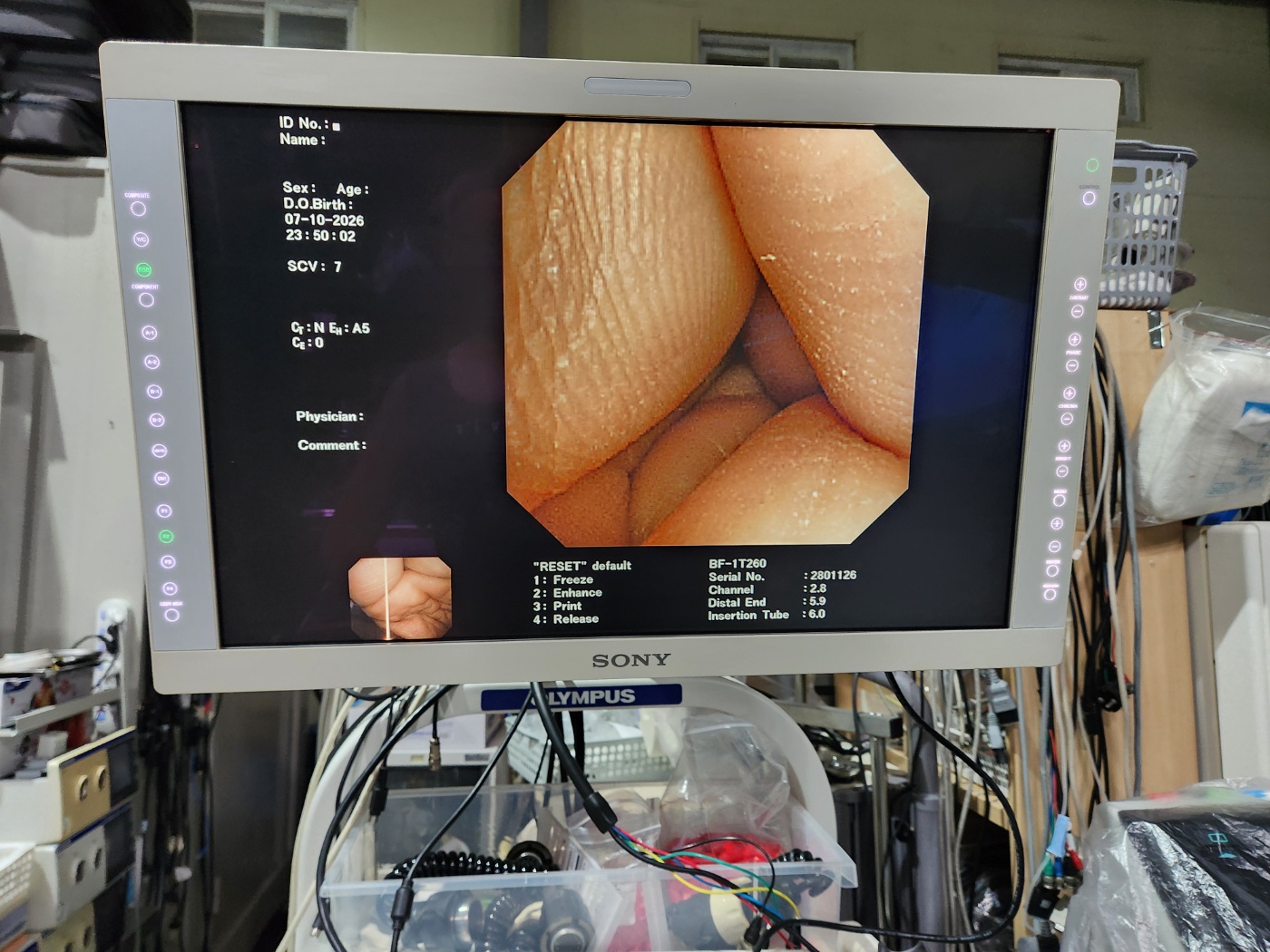 Olympus BF type 1T260 Bronchoscope