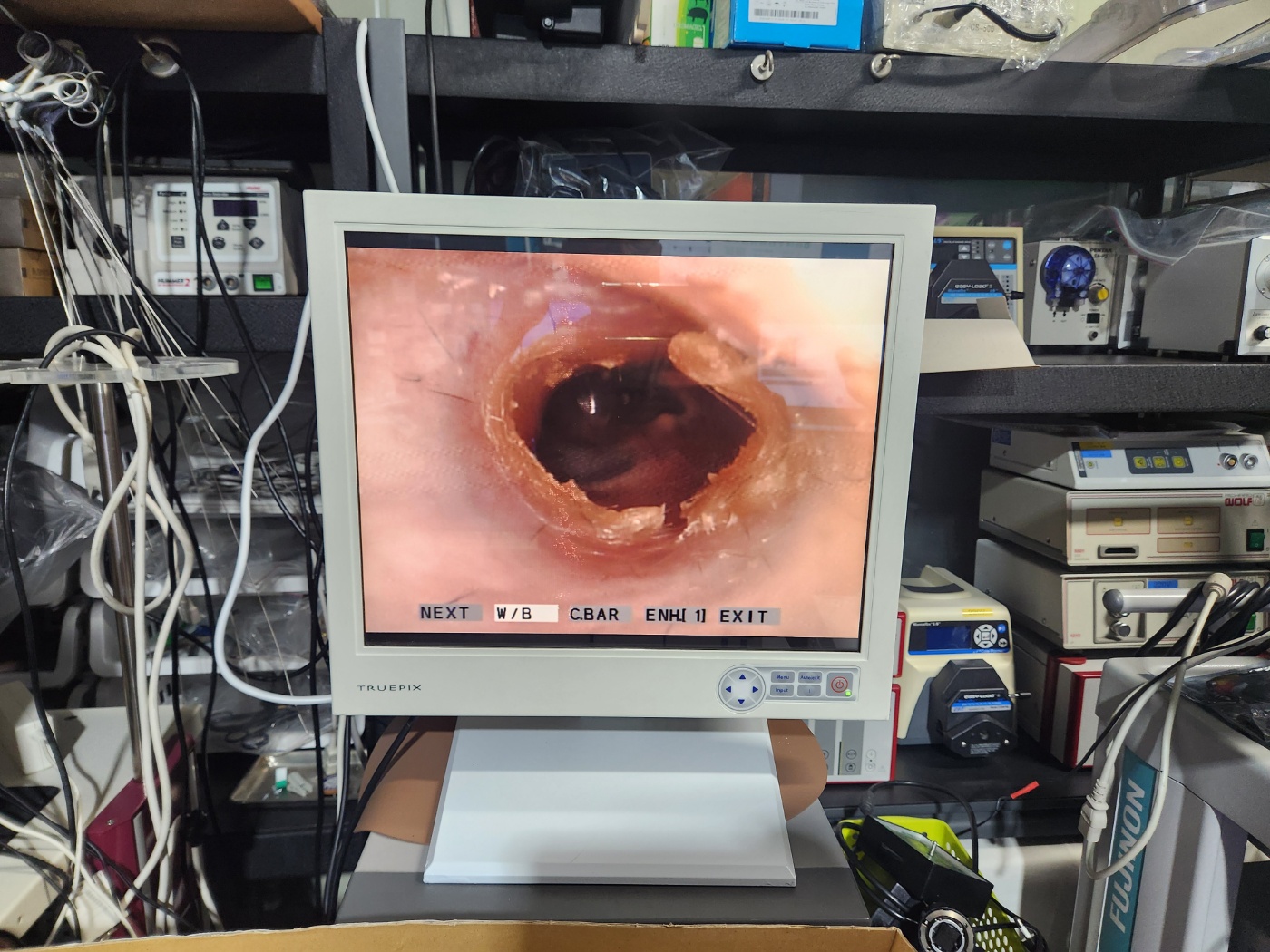 Olympus ENF-VQ Flexible Video Rhinolaryngoscope