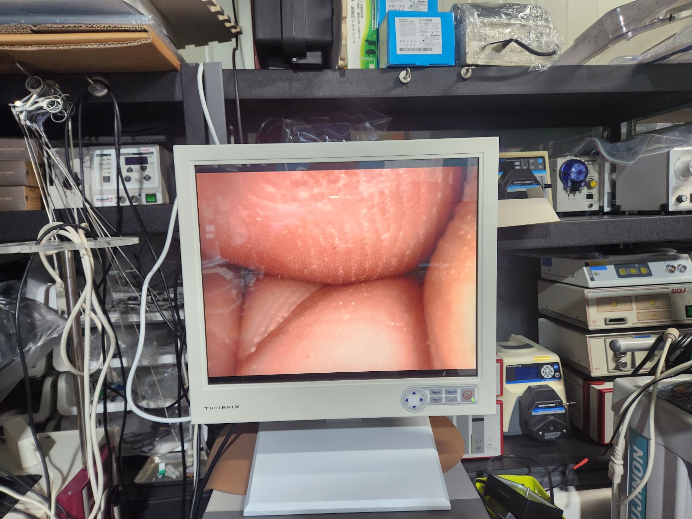 Olympus ENF-VQ Flexible Video Rhinolaryngoscope