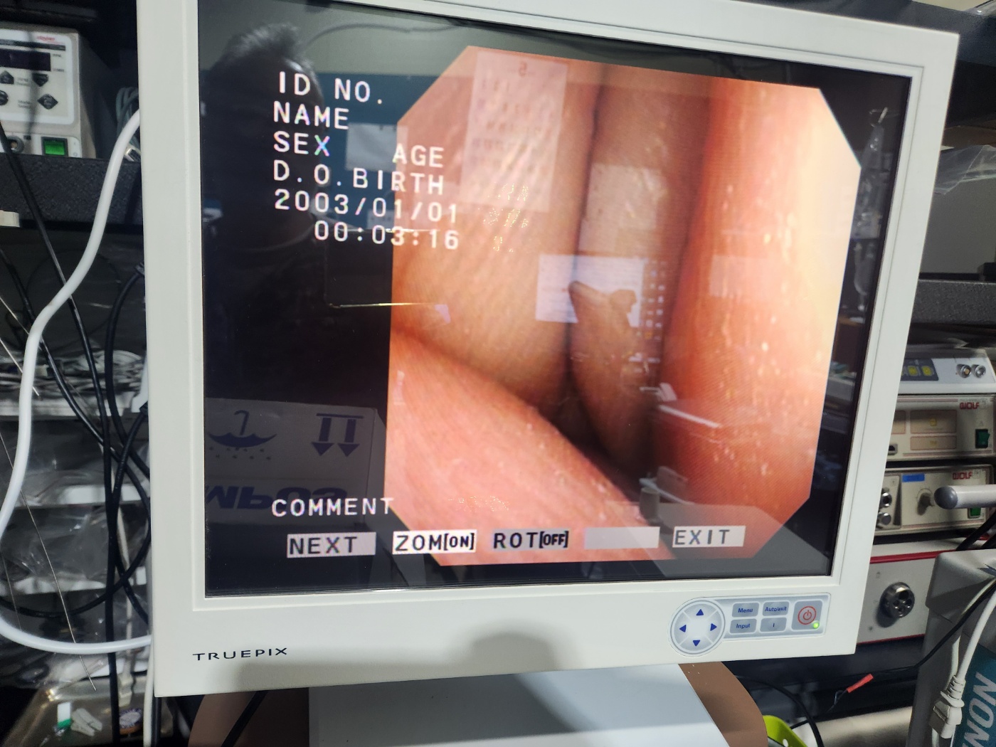 Olympus CYF-VA2 Flexible Video Cystoscope