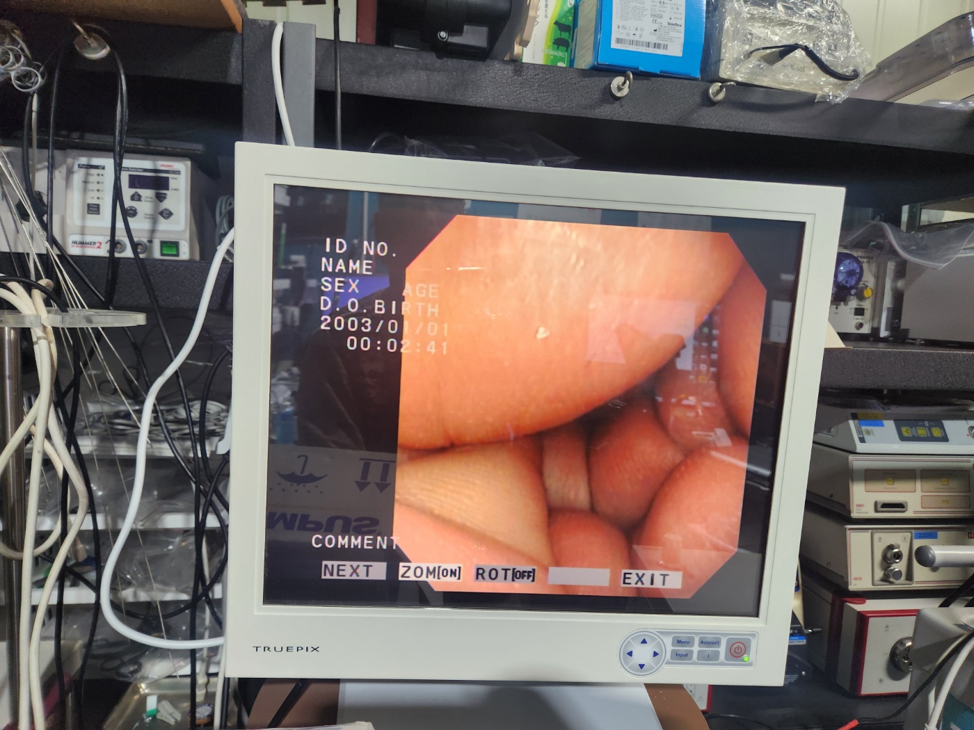 Olympus CYF-VA2 Flexible Video Cystoscope