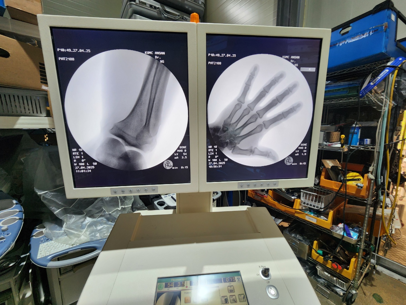Ziehm Vision Mobile C-Arm System