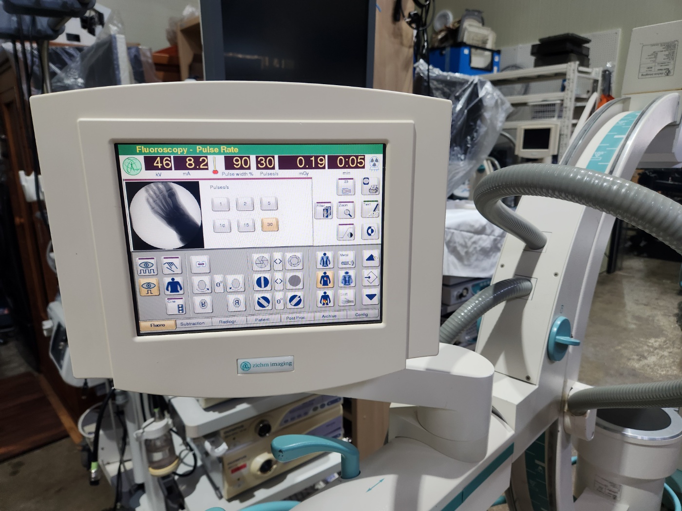 Ziehm Vision Mobile C-Arm System