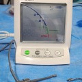 Morita Root ZX II Apex Locator