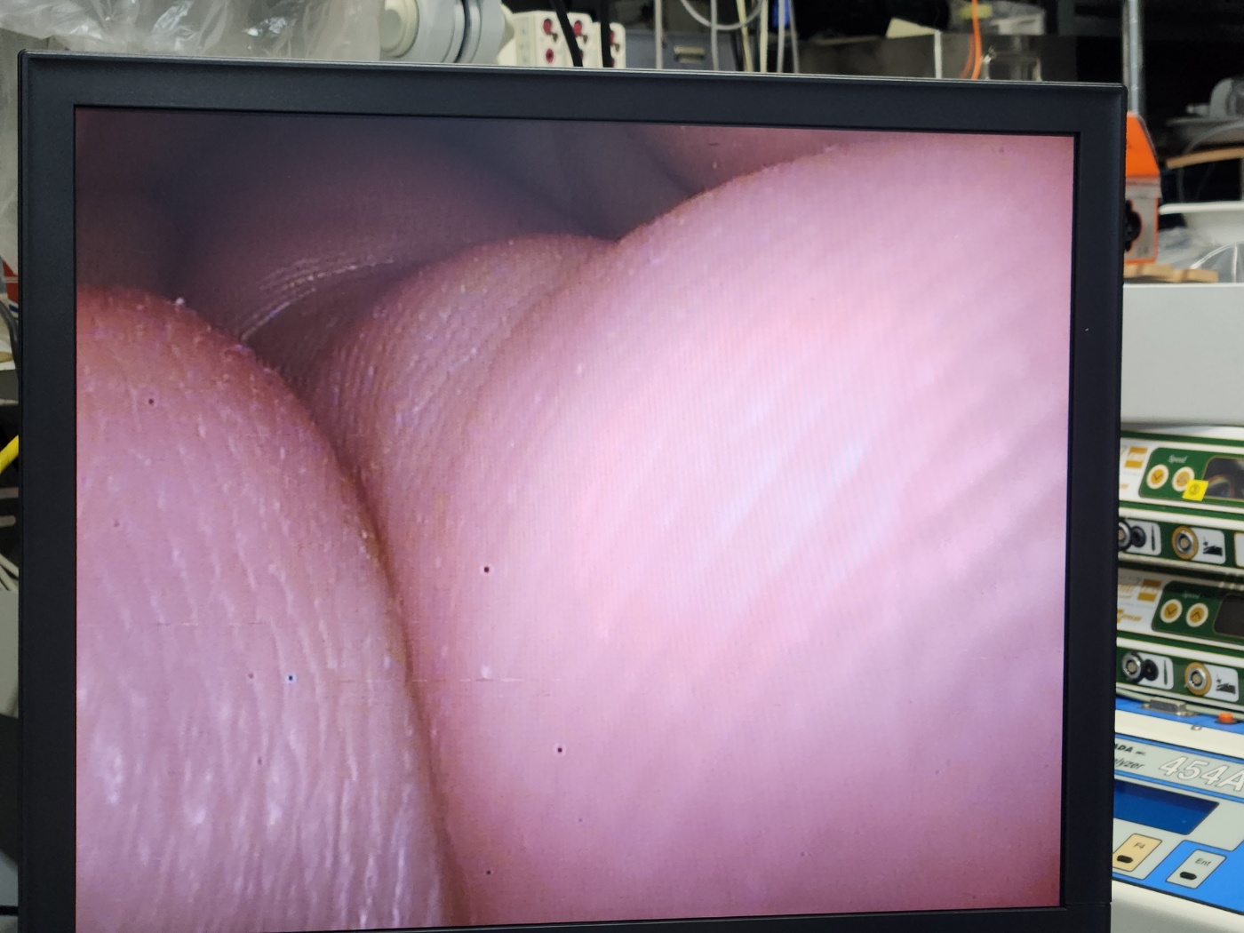 Olympus HD ENDOEYE Video Laparoscope