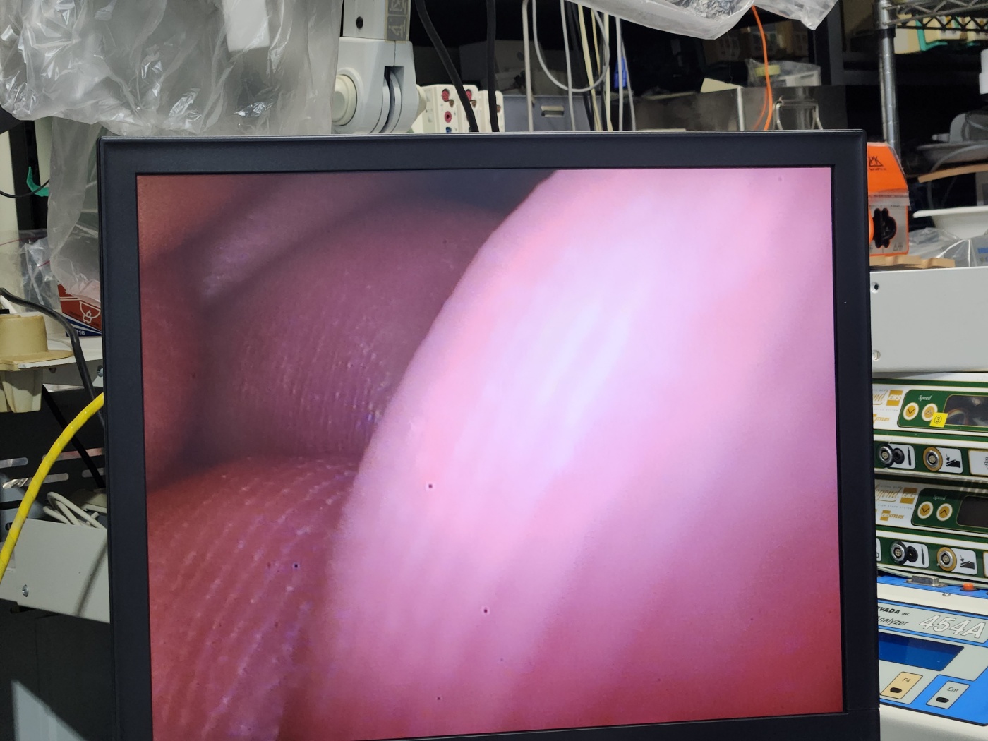 Olympus HD ENDOEYE Video Laparoscope