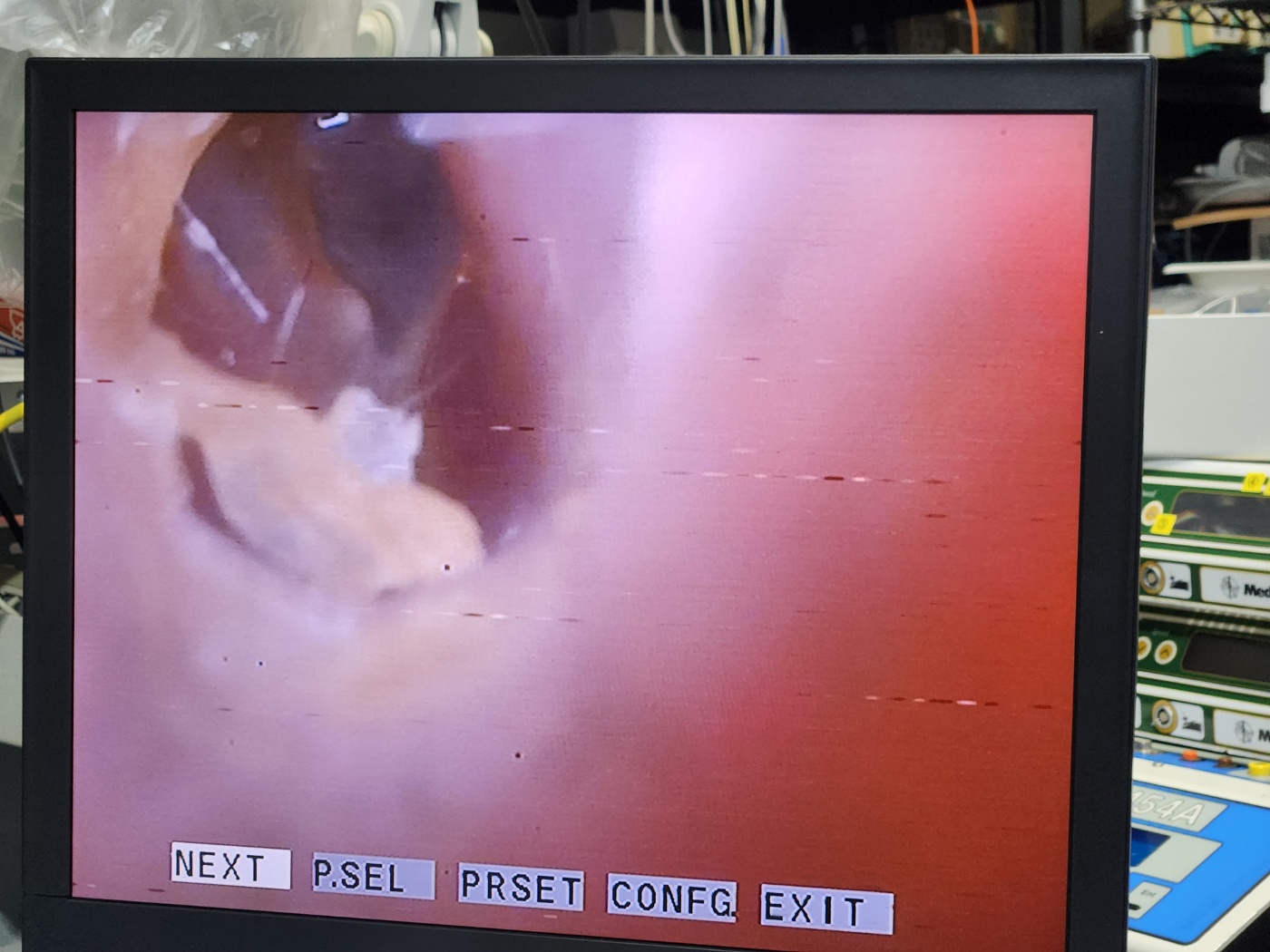 Olympus HD ENDOEYE Video Laparoscope