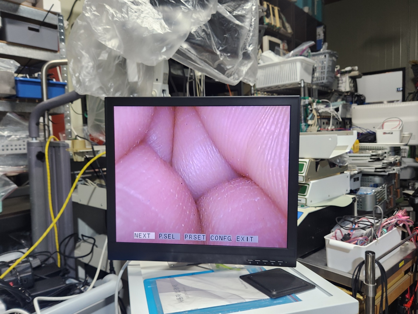 Olympus HD ENDOEYE Video Laparoscope