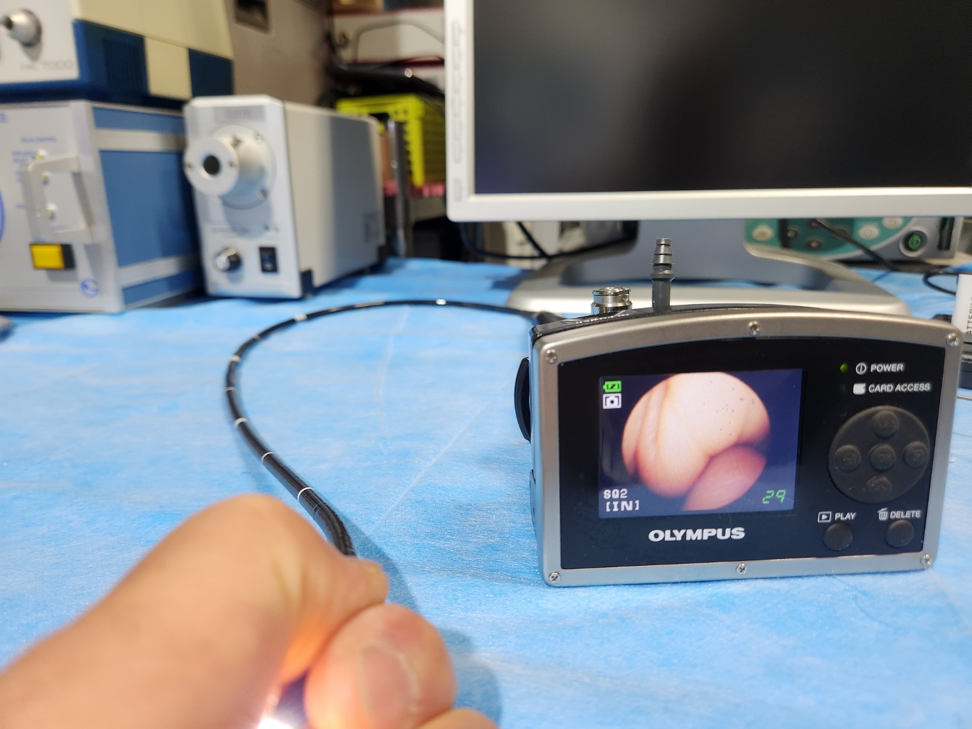 OLYMPUS MAF TYPE TM Airway Mobilescope