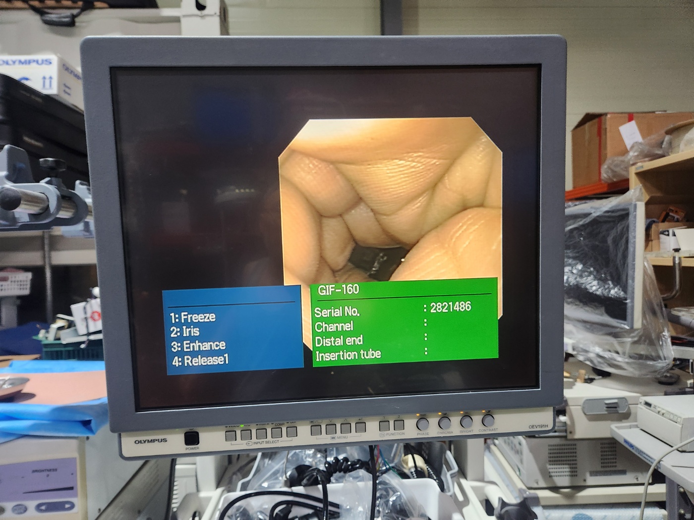 Olympus CV-180 HD Endoscopy System
