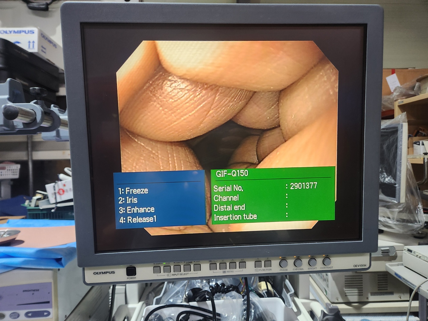 Olympus CV-180 HD Endoscopy System