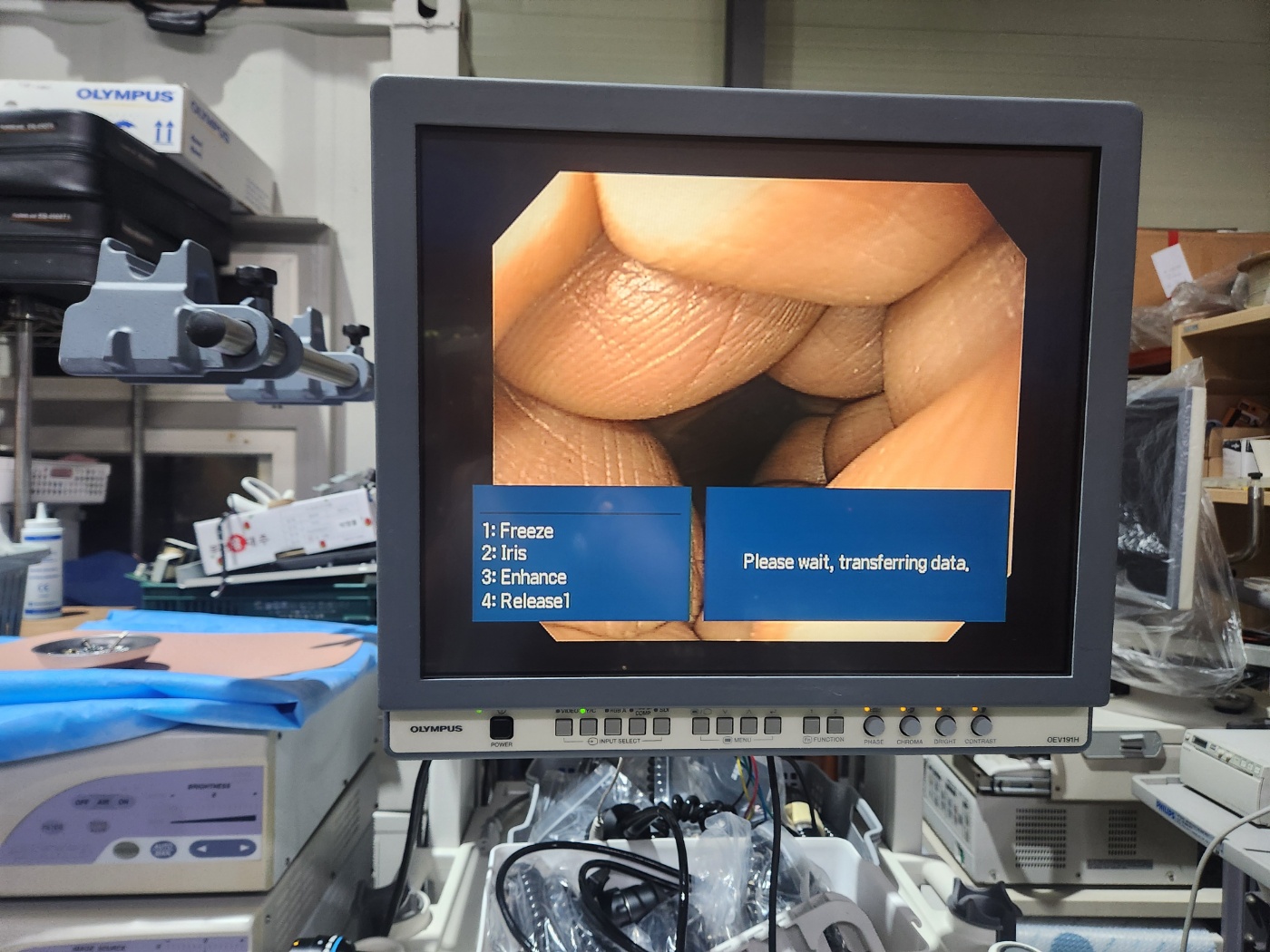 Olympus CV-180 HD Endoscopy System