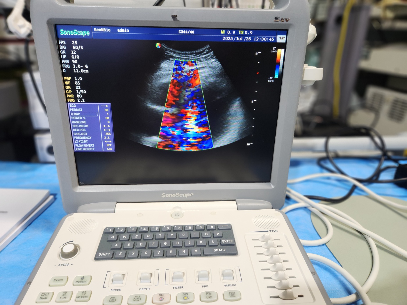 SonoScape Portable Ultrasound