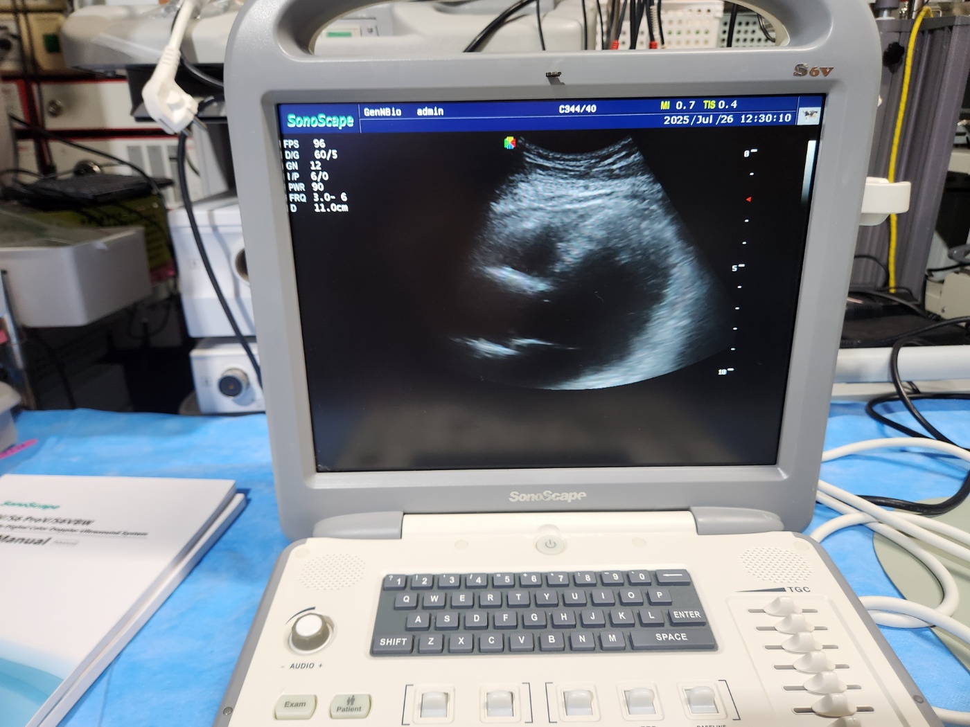 SonoScape Portable Ultrasound