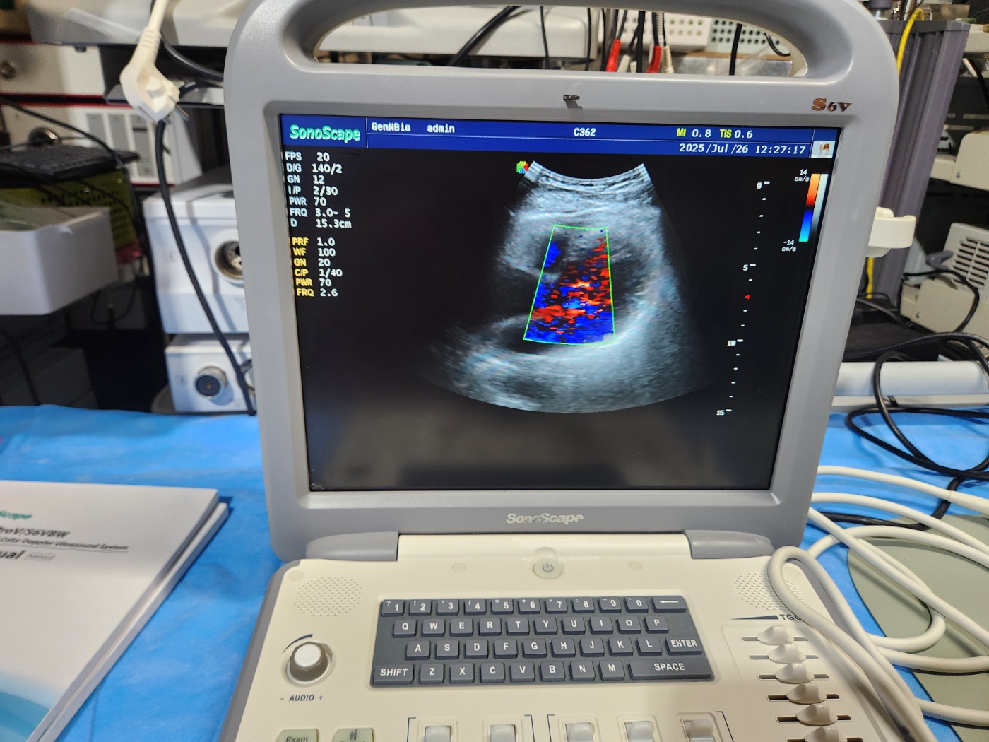 SonoScape Portable Ultrasound