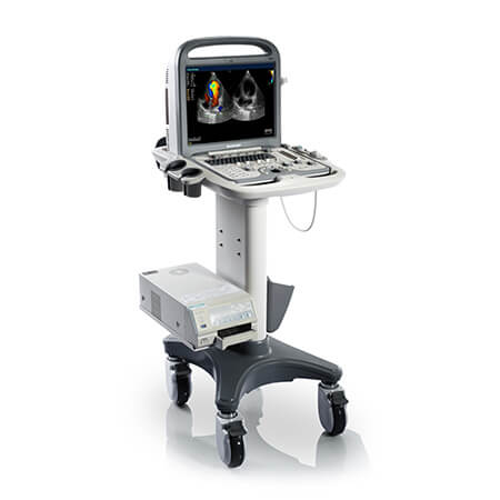 SonoScape Portable Ultrasound