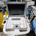 SonoScape Portable Ultrasound