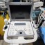 SonoScape Portable Ultrasound