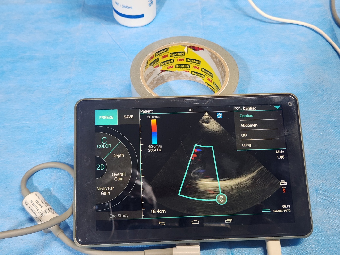 Sonosite iVIZ Ultrasound Machine