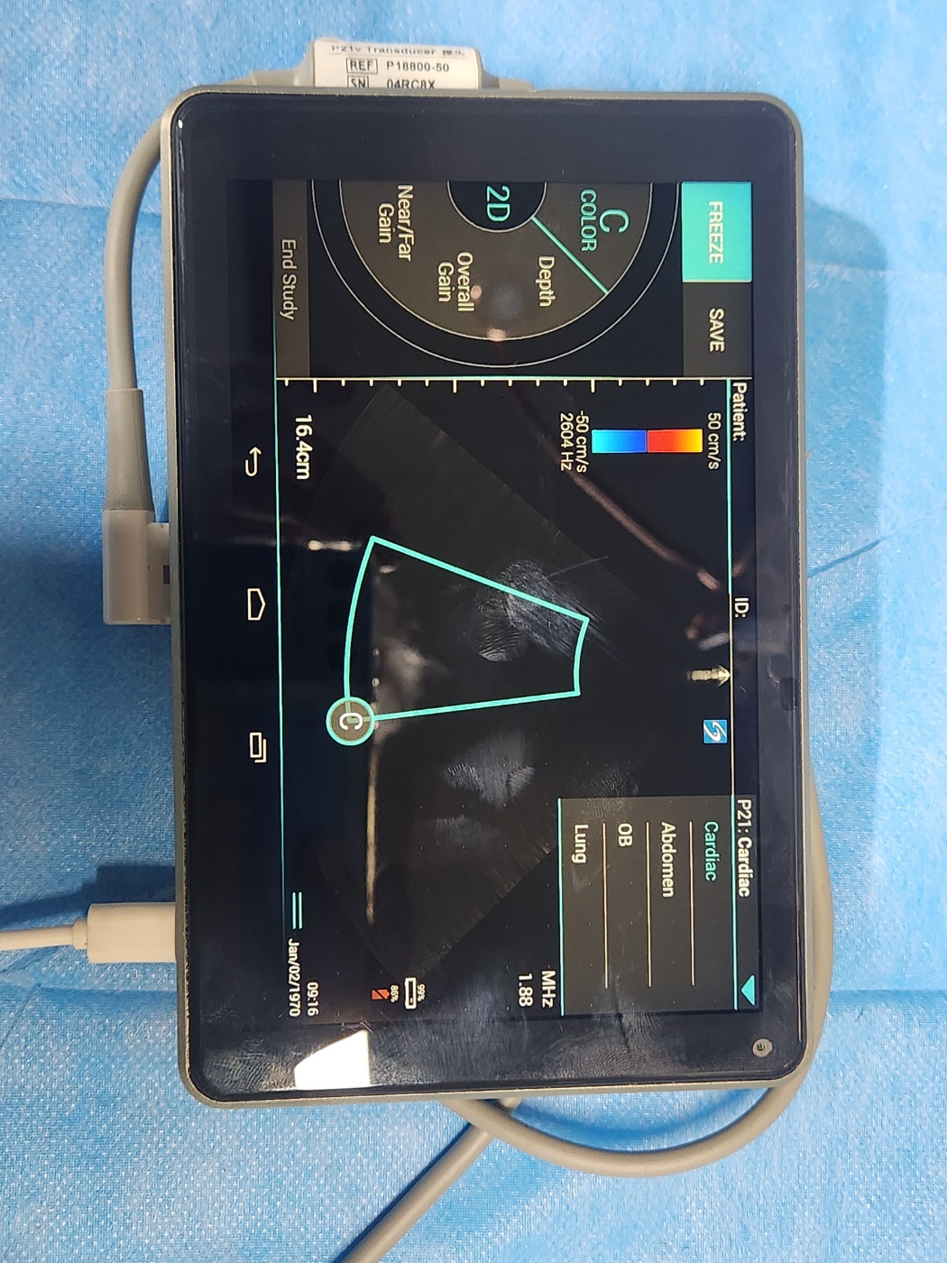Sonosite iVIZ Ultrasound Machine
