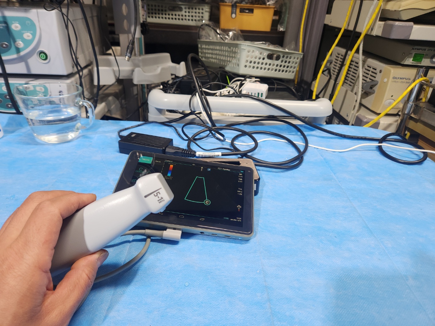 Sonosite iVIZ Ultrasound Machine