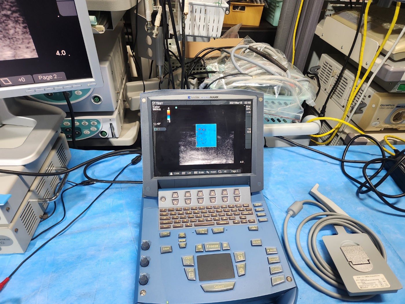 Sonosite MicroMaxx Ultrasound system
