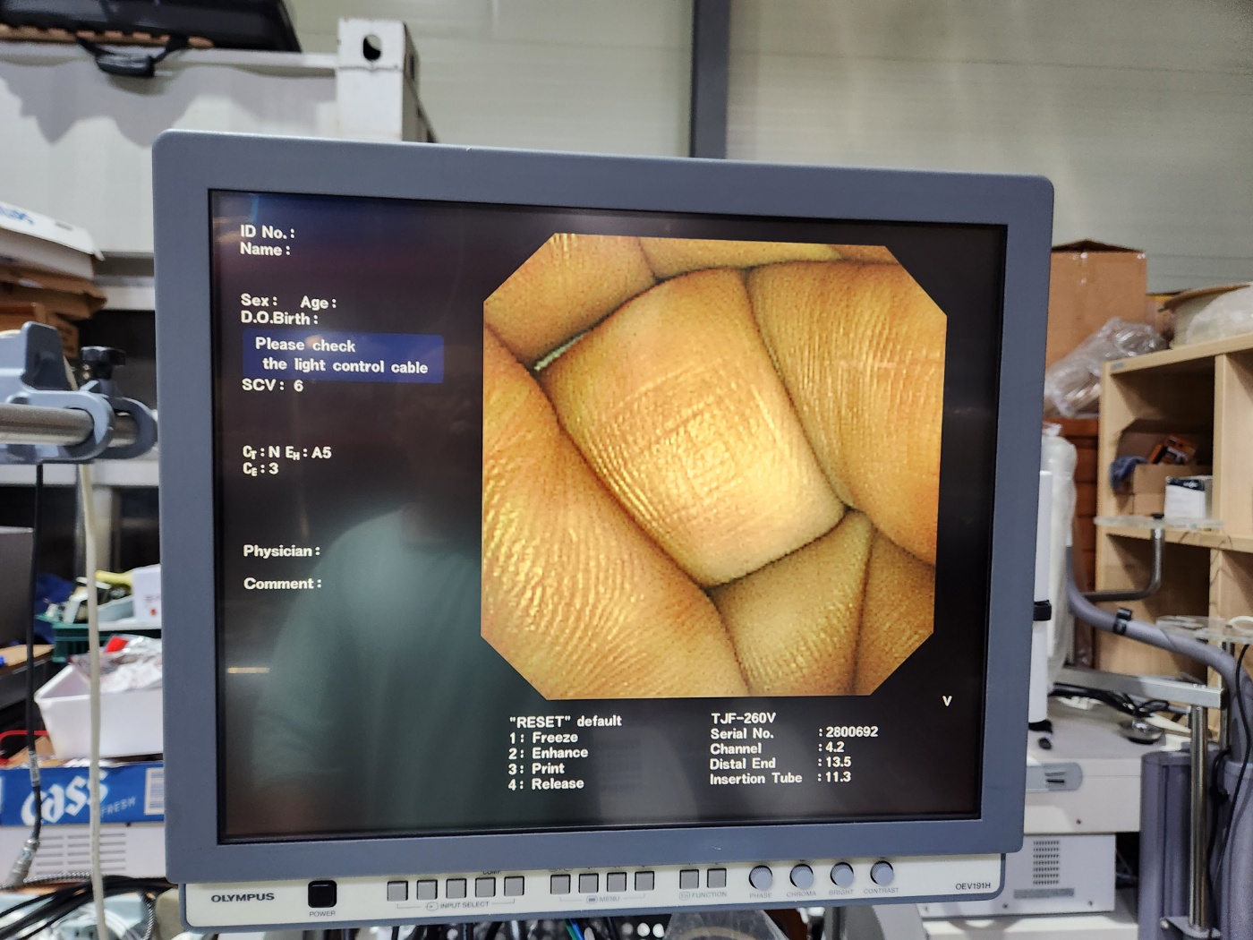 Olympus MAJ-1154 Pigtail