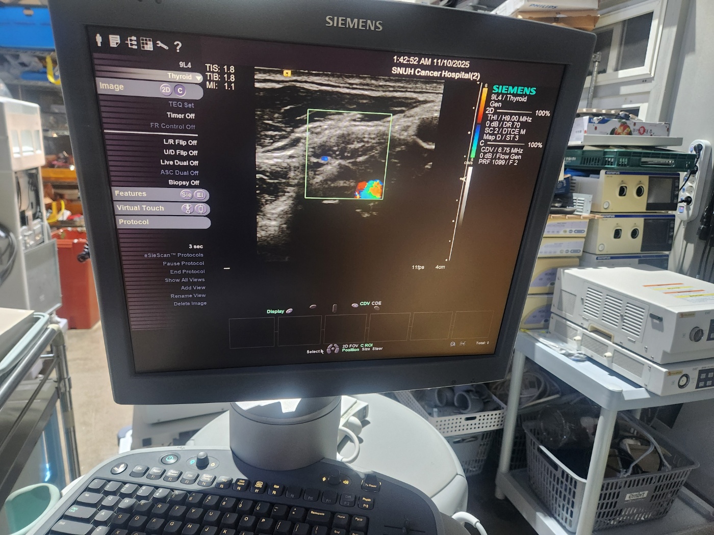 Siemens Acuson S2000   Ultrasound System