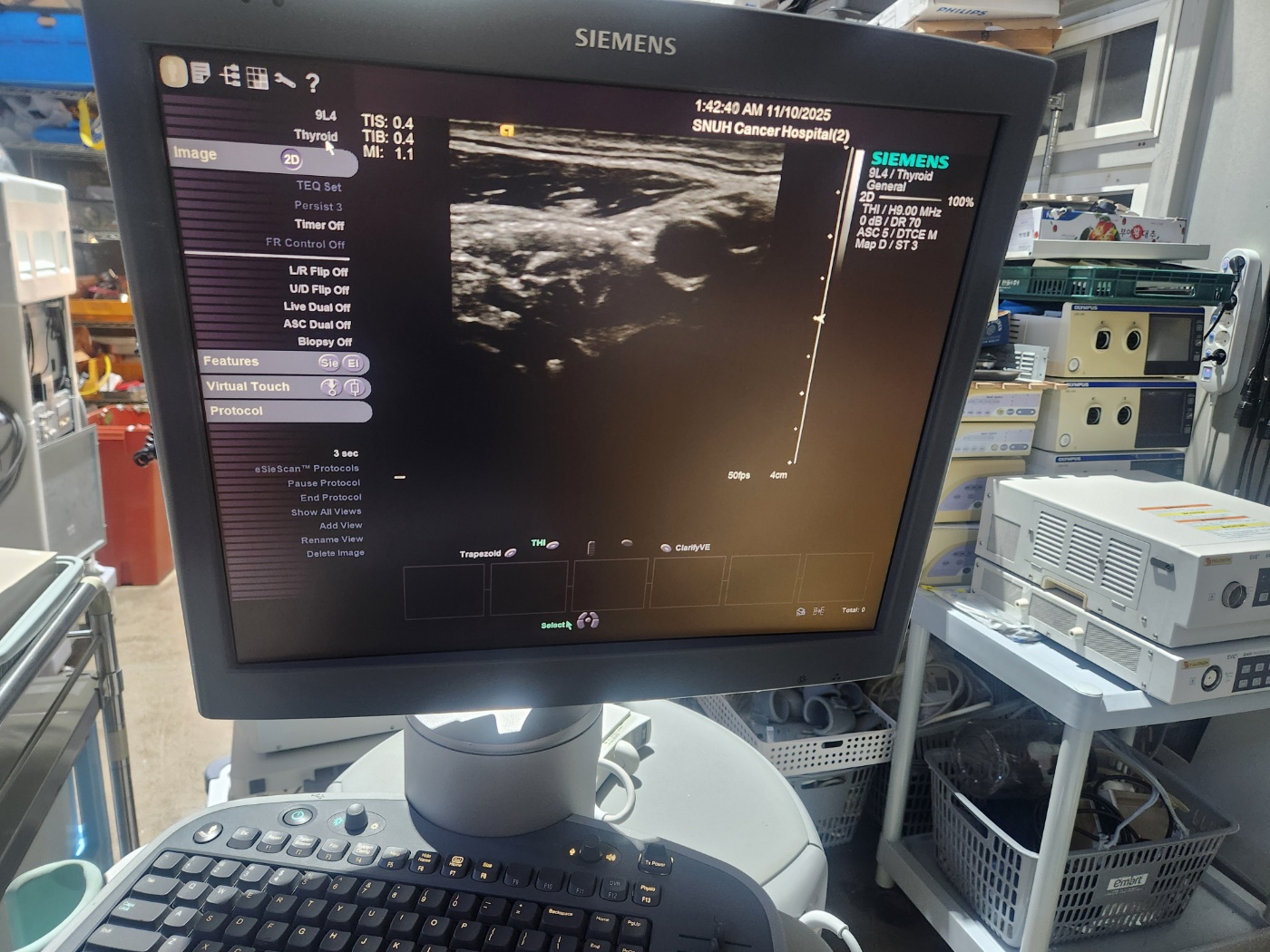 Siemens Acuson S2000   Ultrasound System