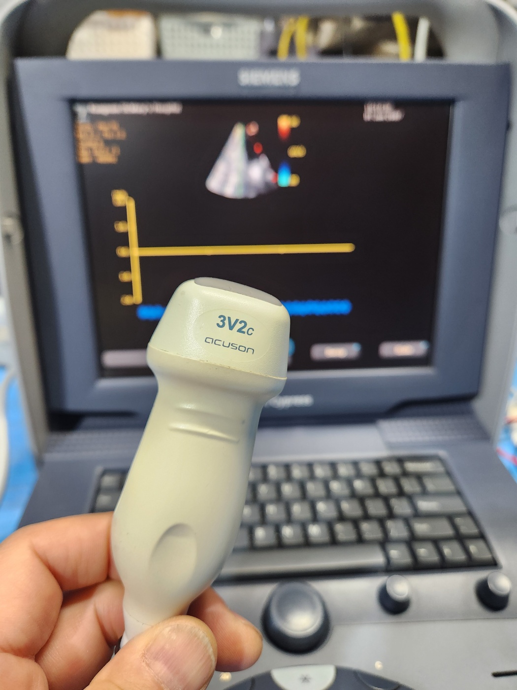 Siemens Acuson Cypress Ultrasound with 2 probes