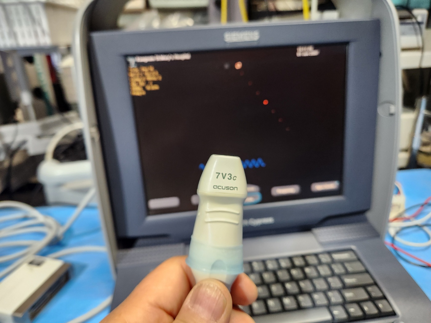 Siemens Acuson Cypress Ultrasound with 2 probes