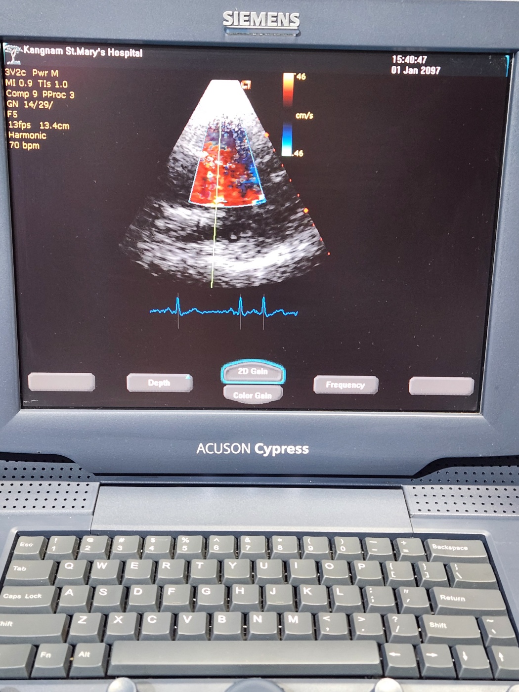 Siemens Acuson Cypress Ultrasound with 2 probes