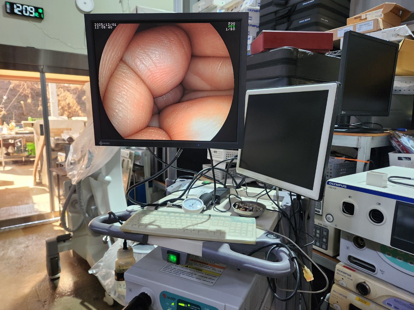 Fujinon EPX-2500 HD Complete Endoscopy System