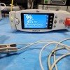 Masimo Radical 7 Pulse CO-Oximeter