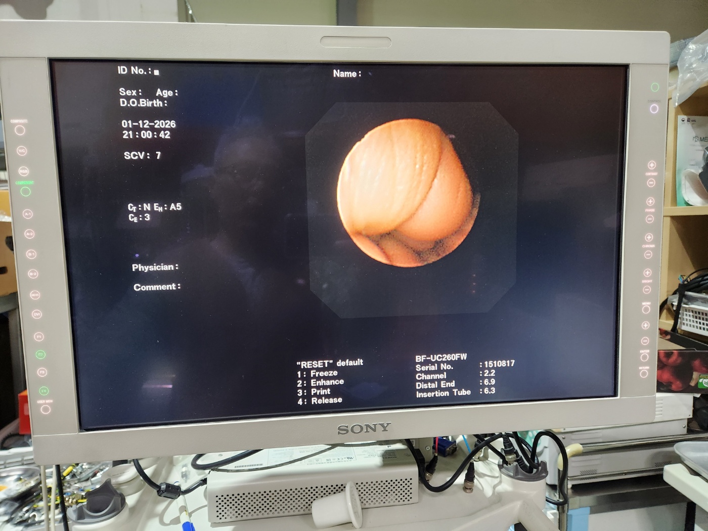 Olympus BF-UC260FW  Linear Ultrasound Bronchoscope