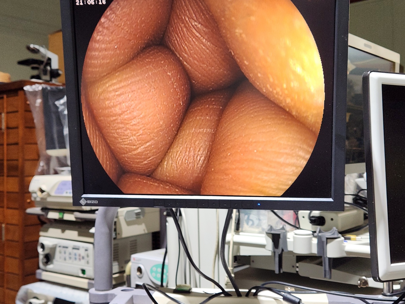 Fujinon EG-450WR5 Gastroscope