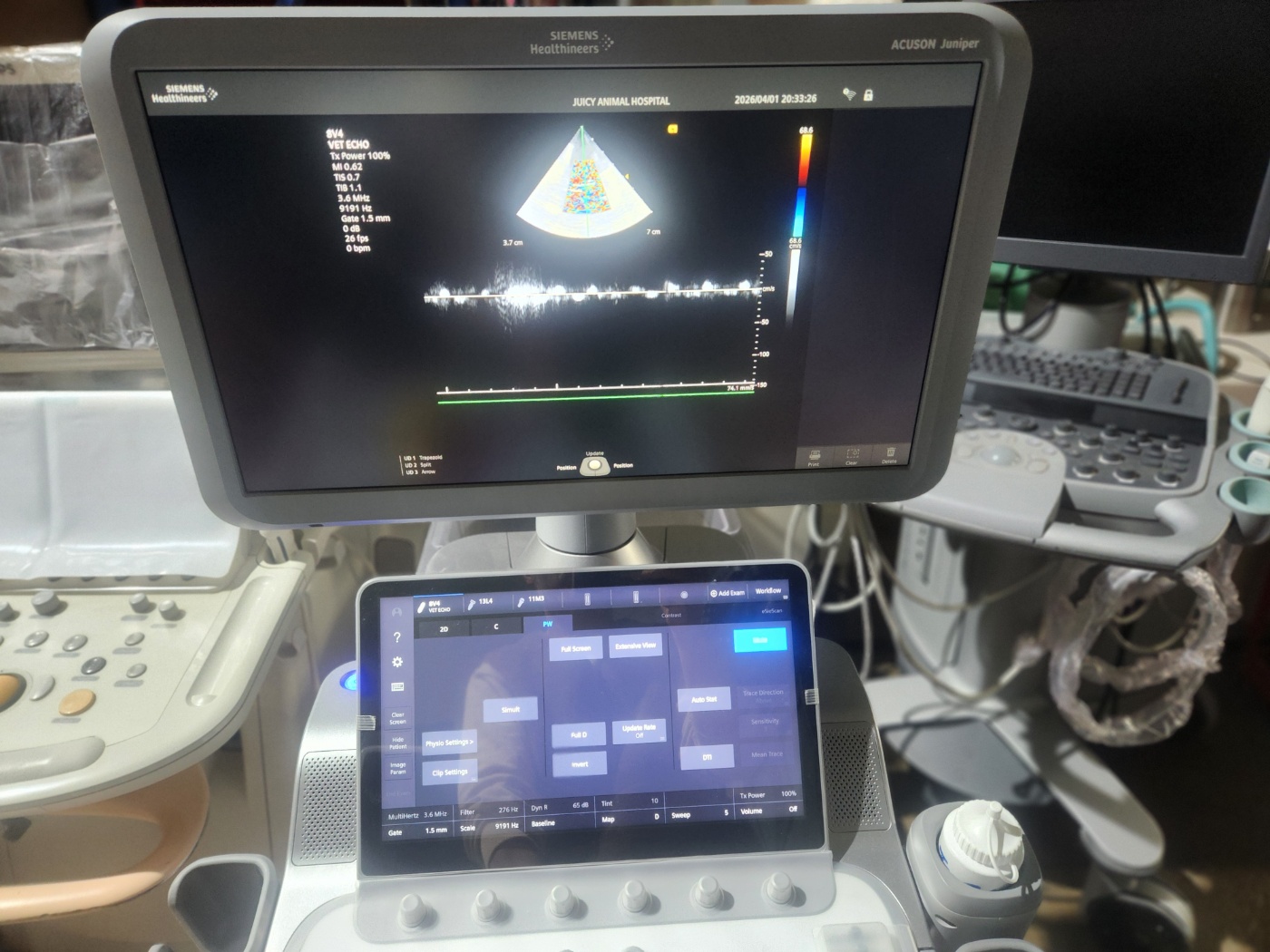 SIEMENS ACUSON Juniper