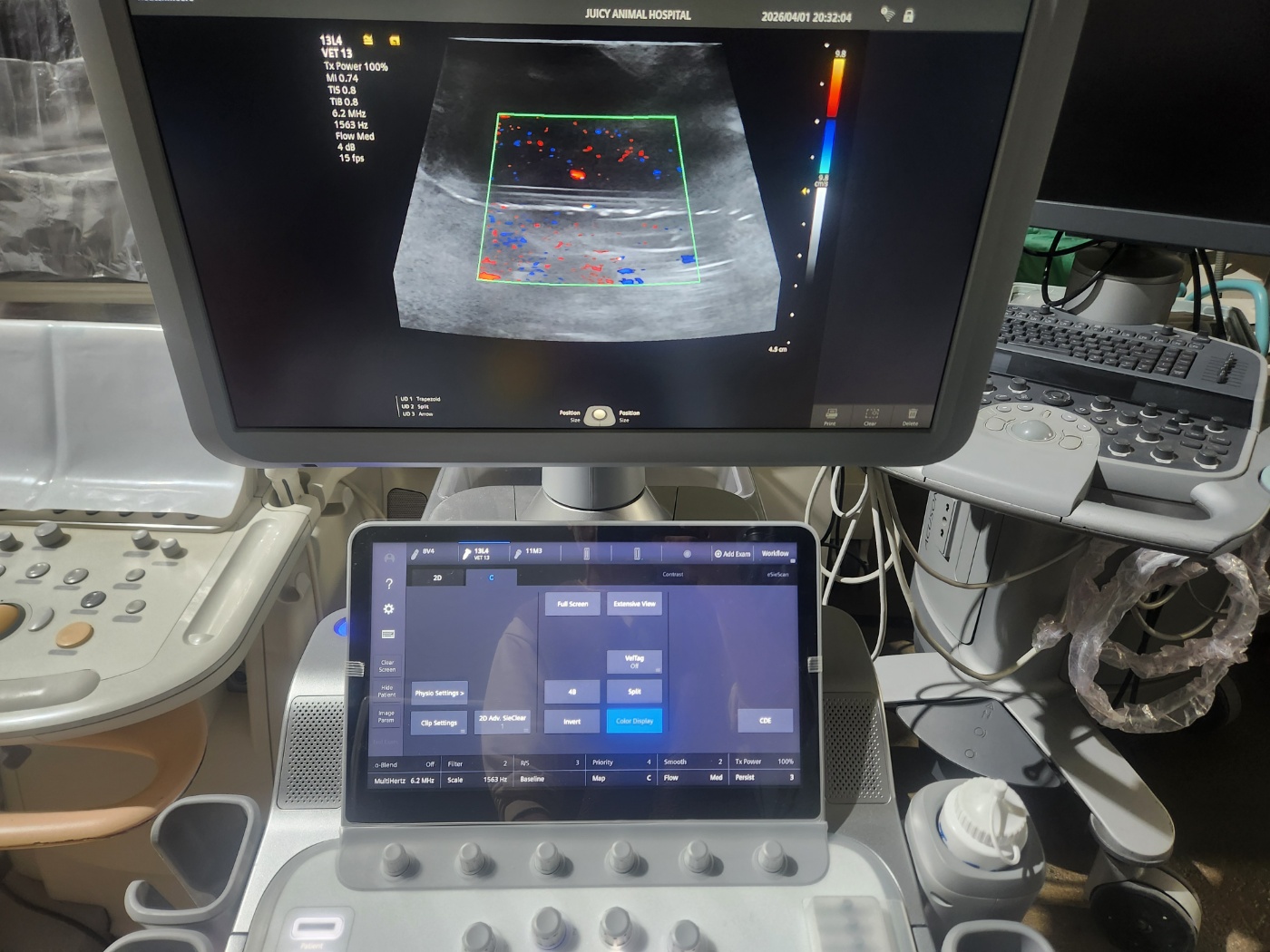 SIEMENS ACUSON Juniper