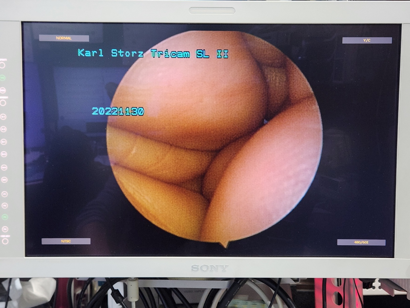 Karl Storz Tricam SL II Camera System