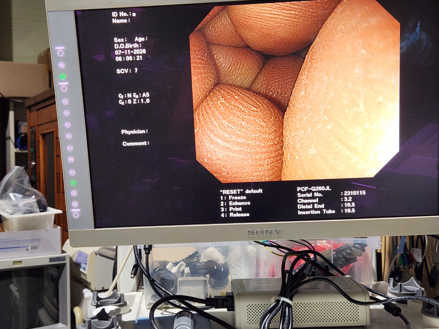 Olympus PCF-Q260JL Colonoscope