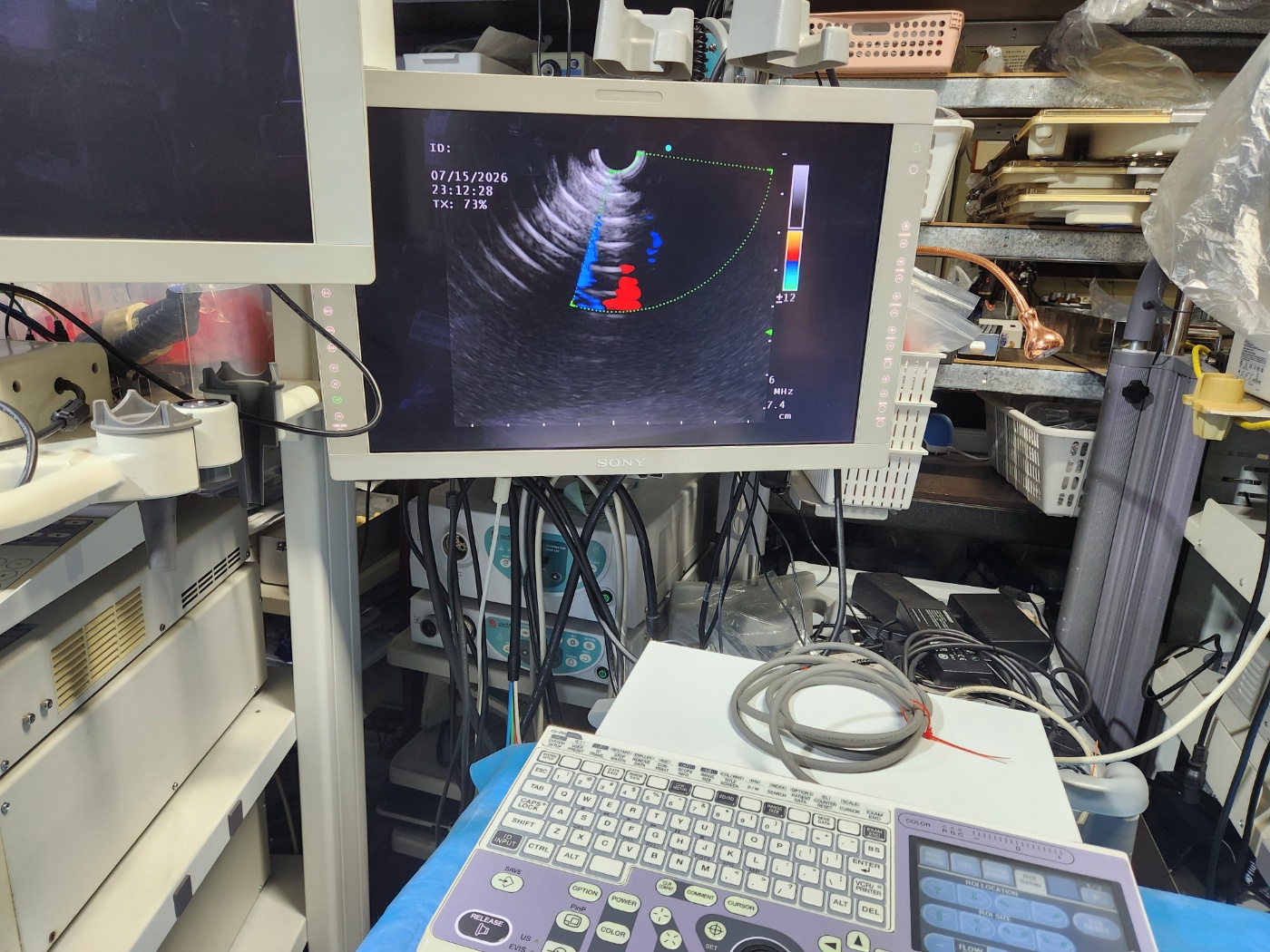 Olympus EU-ME1 Universal Endoscopic Ultrasound Processor